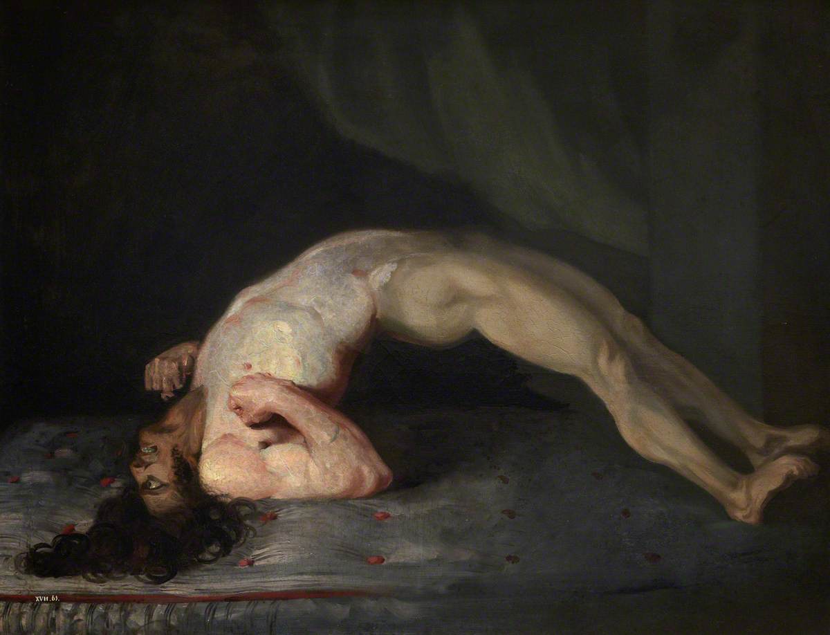 Oil painting from 1809 by Sir Charles Bell showing a soldier with tetanus, his body rigidly arched backwards so that only his head and heels rest on the bed, jaw clenched and face fixed in a grimace